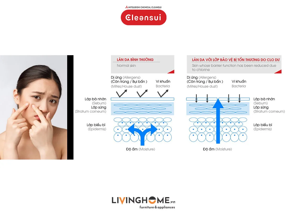 Vòi sen tắm Cleansui ES201W khử clo nhập khẩu Nhật - Ảnh 4